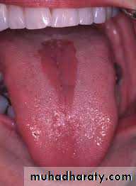 dr asmaa red and white lesions