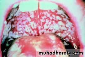 dr asmaa red and white lesions