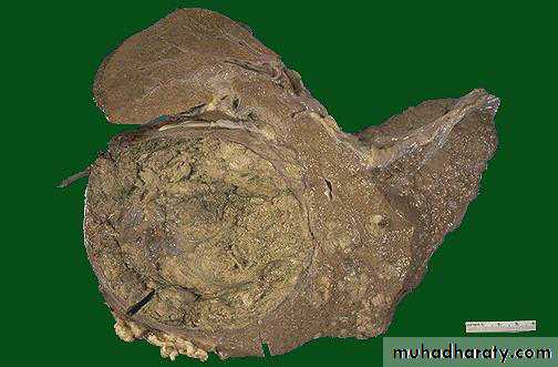liver