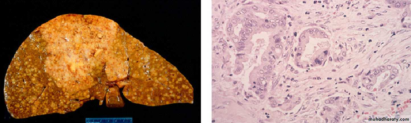 liver