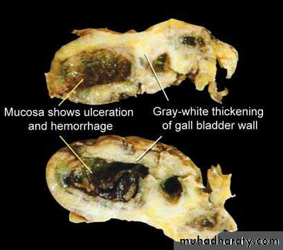 liver