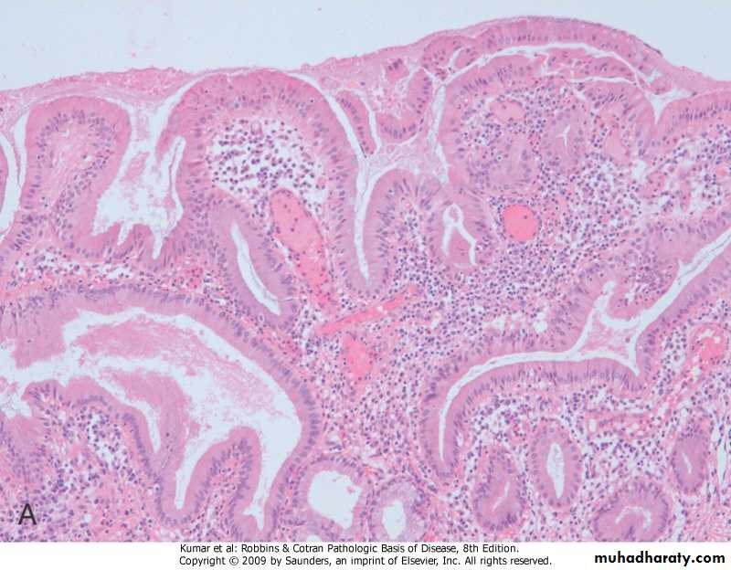 liver