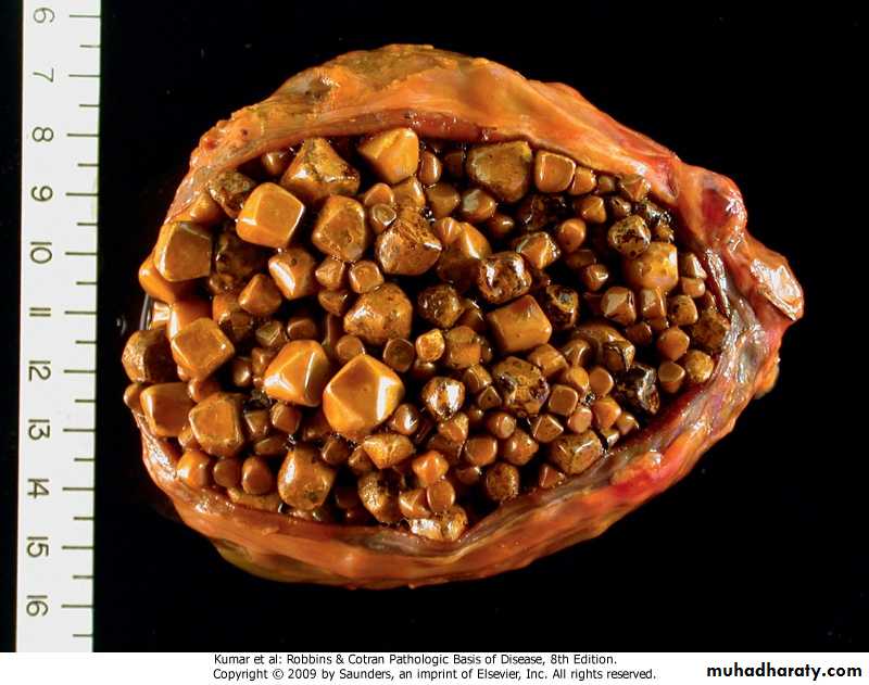 liver