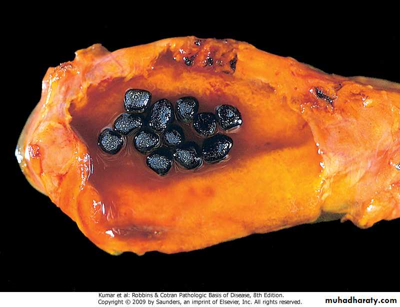liver