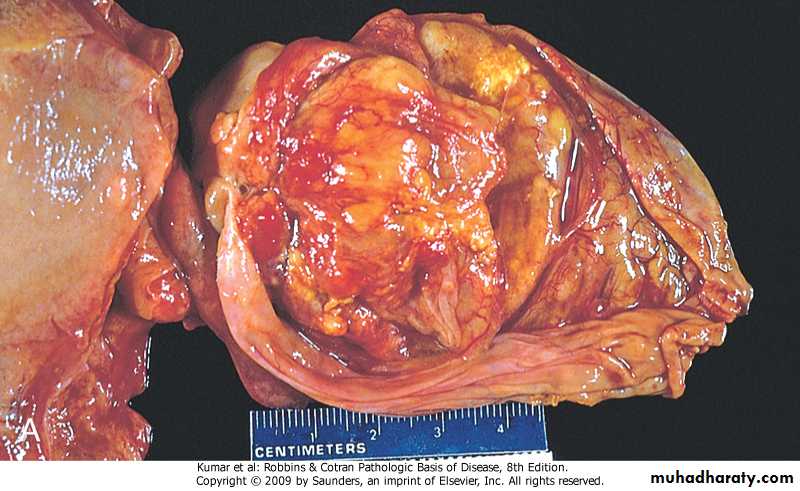 liver