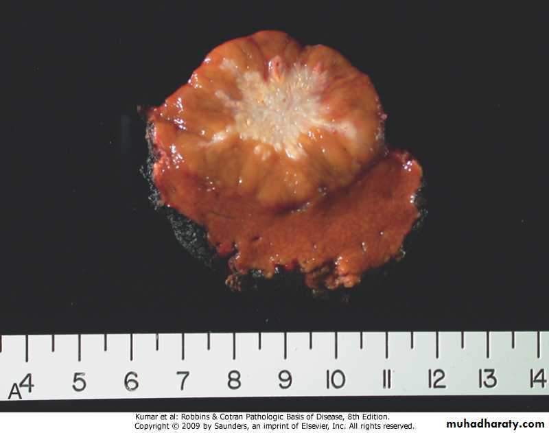 liver