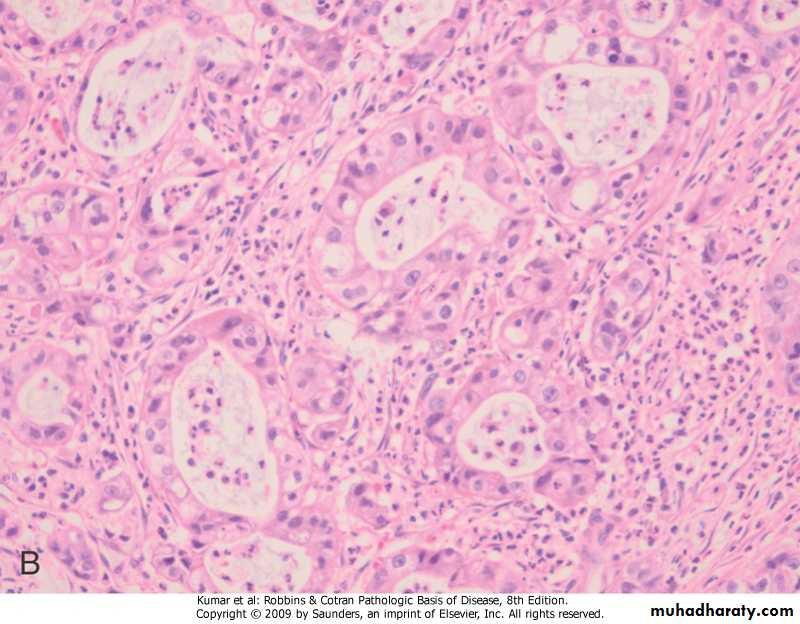 liver