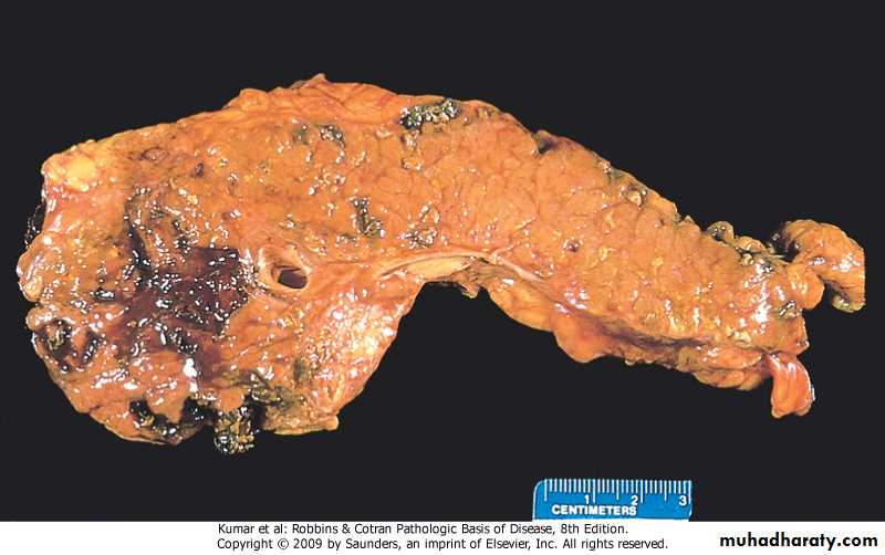 liver