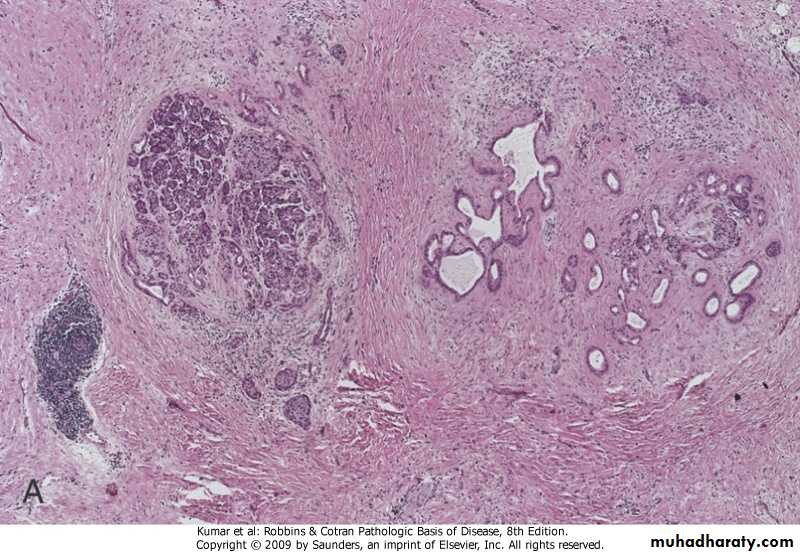 liver