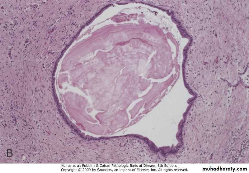 liver