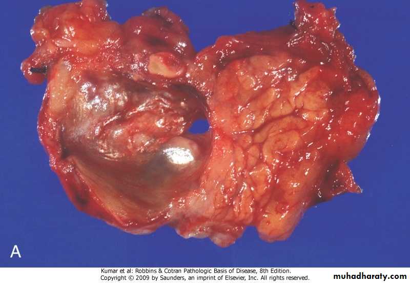 liver