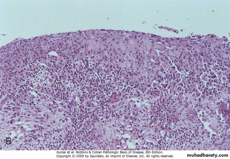 liver