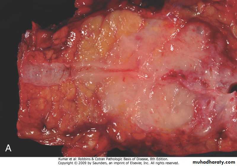liver