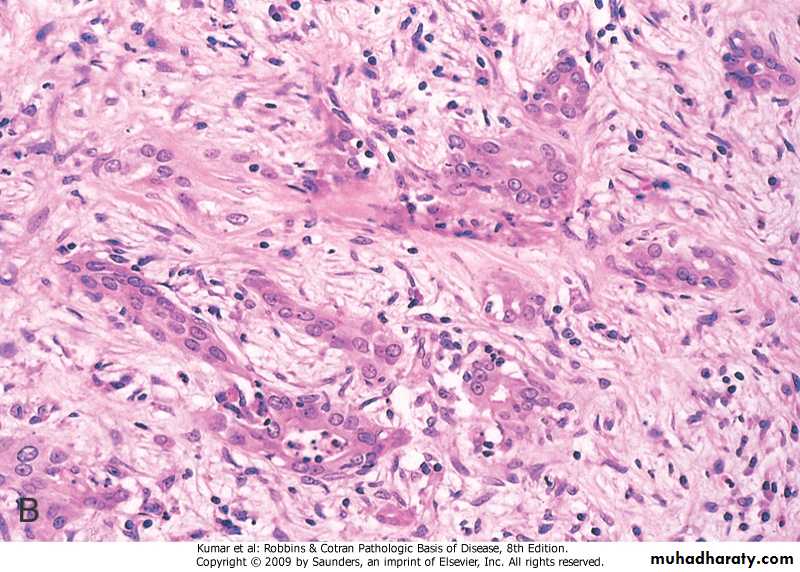liver