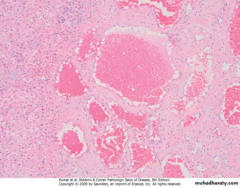liver
