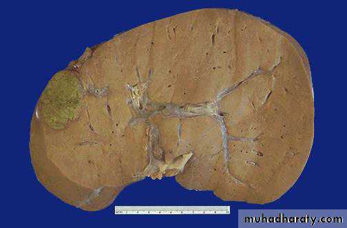 liver