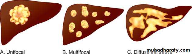 liver