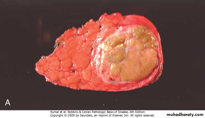 liver