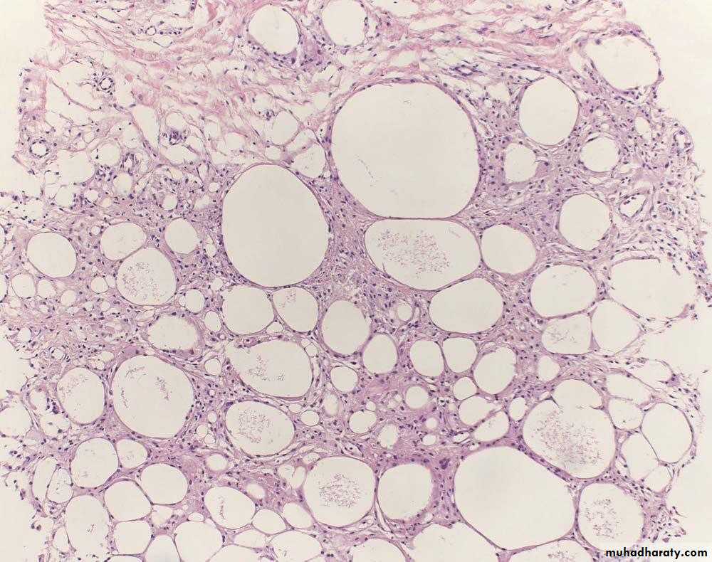 Breast