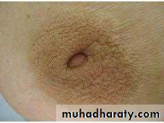 Breast