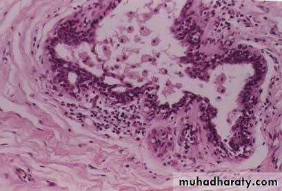 Breast