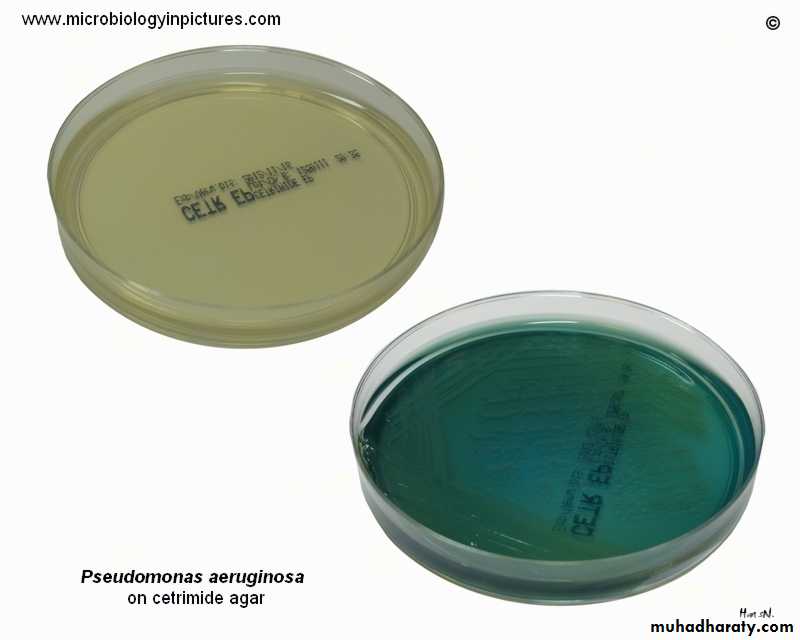Genus Proteus & Genus Pseudomonas