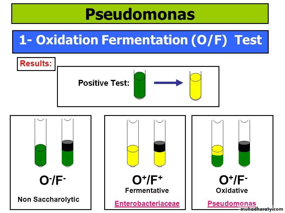 Genus Proteus & Genus Pseudomonas