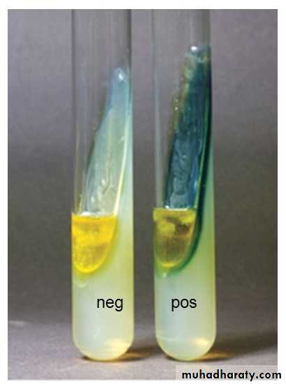 Genus Proteus & Genus Pseudomonas
