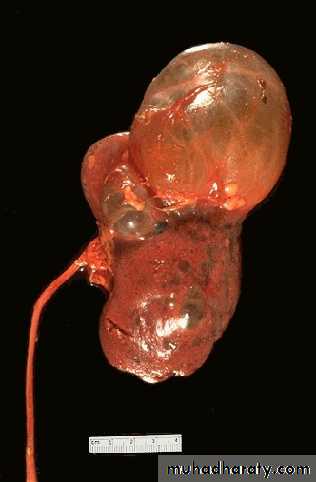 Renal System