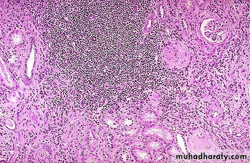 Renal System