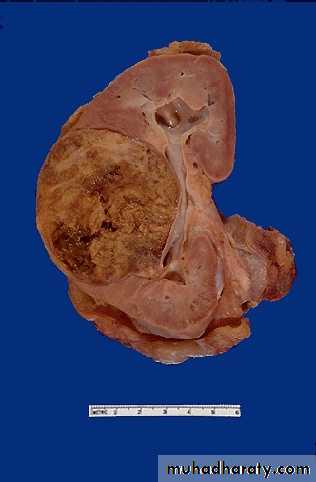 Renal System