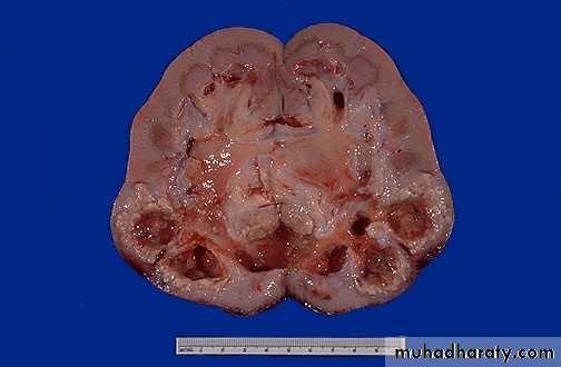 Renal System