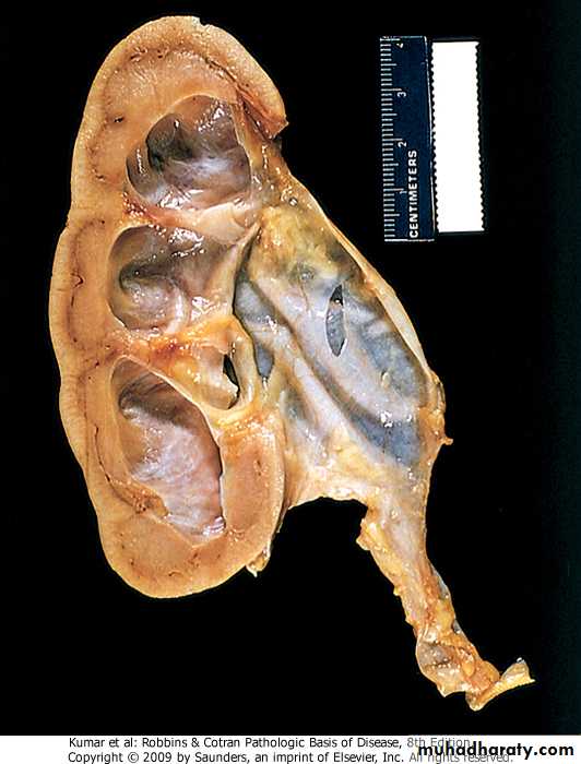 Renal System