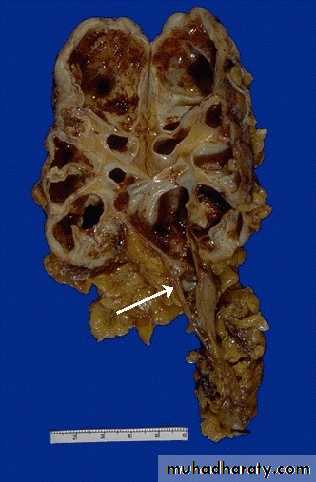 Renal System