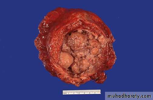Renal System