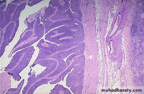 Renal System