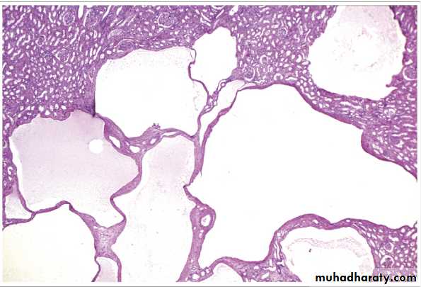 Renal System