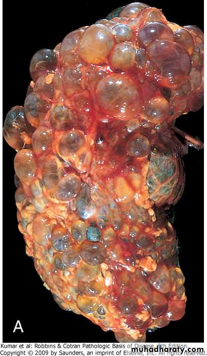 Renal System