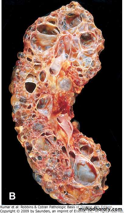 Renal System
