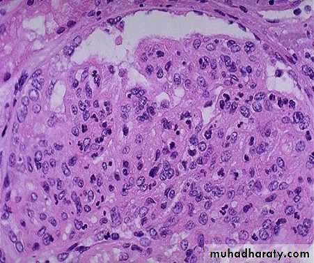 Renal System