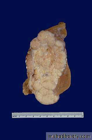Renal System