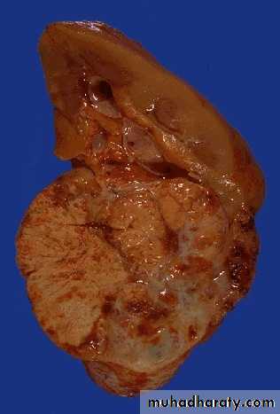 Renal System
