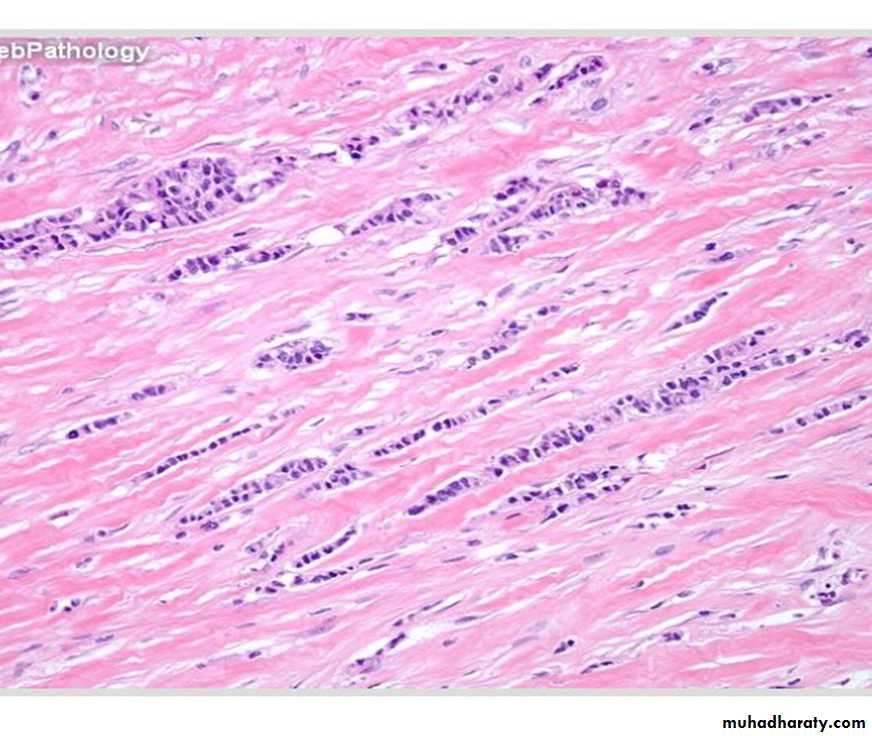Breast