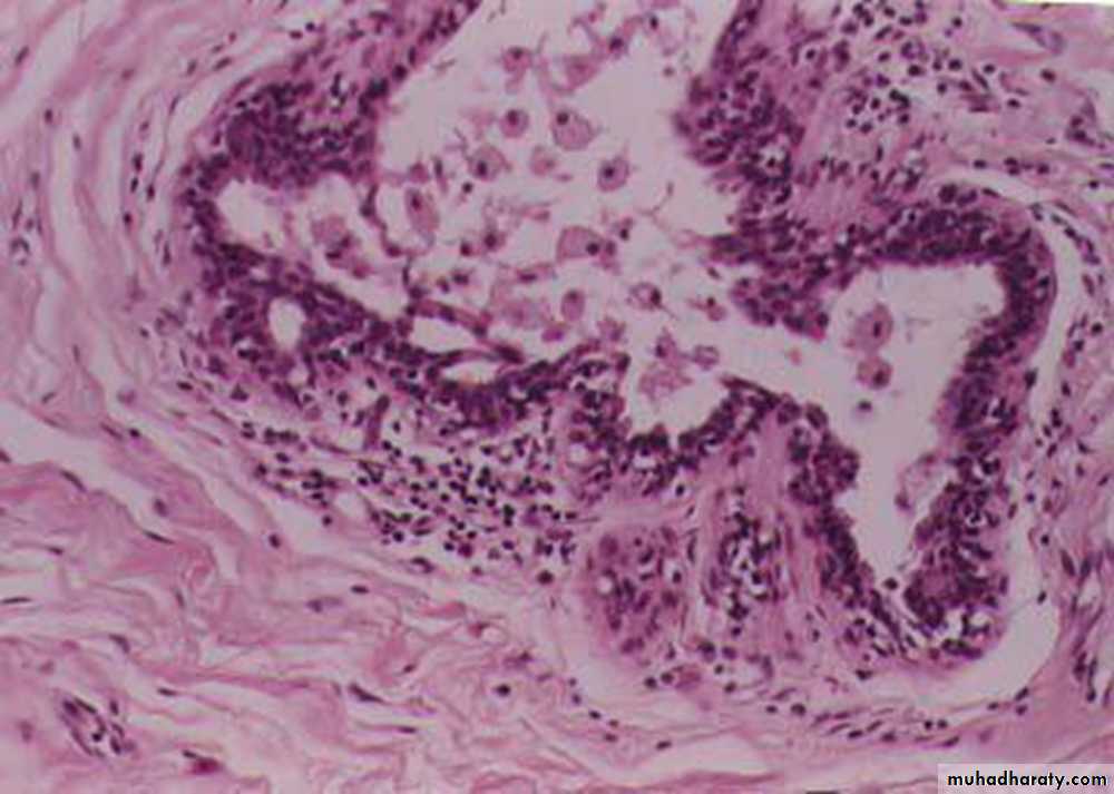 Breast
