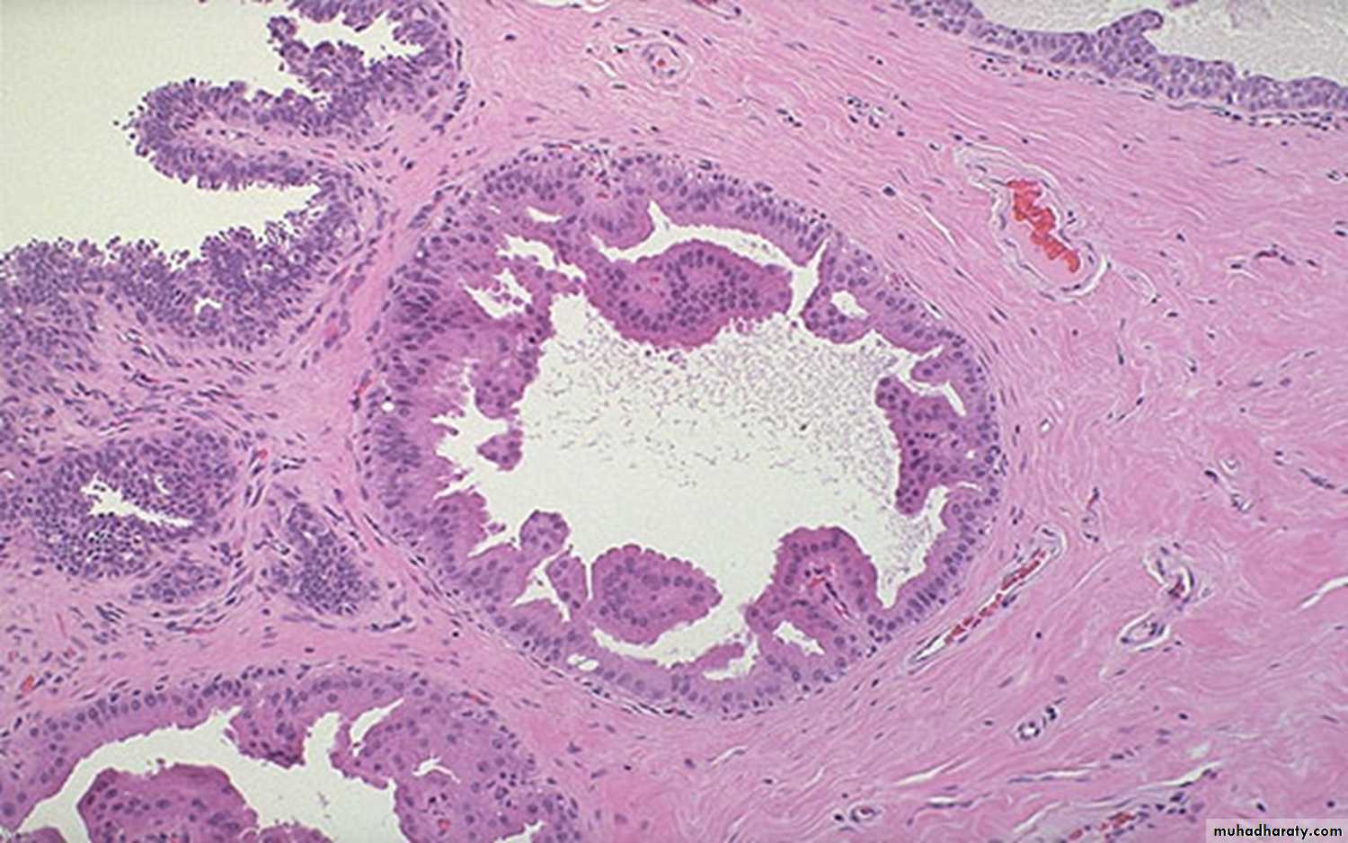 Breast