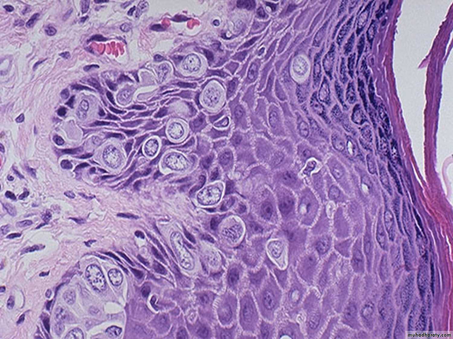 Breast