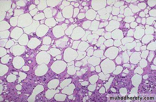 Breast pathology