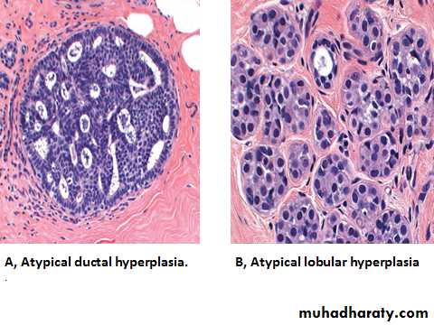 Breast pathology