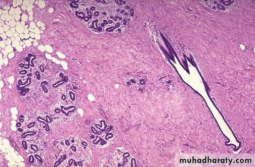 Breast pathology