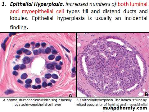 Breast pathology